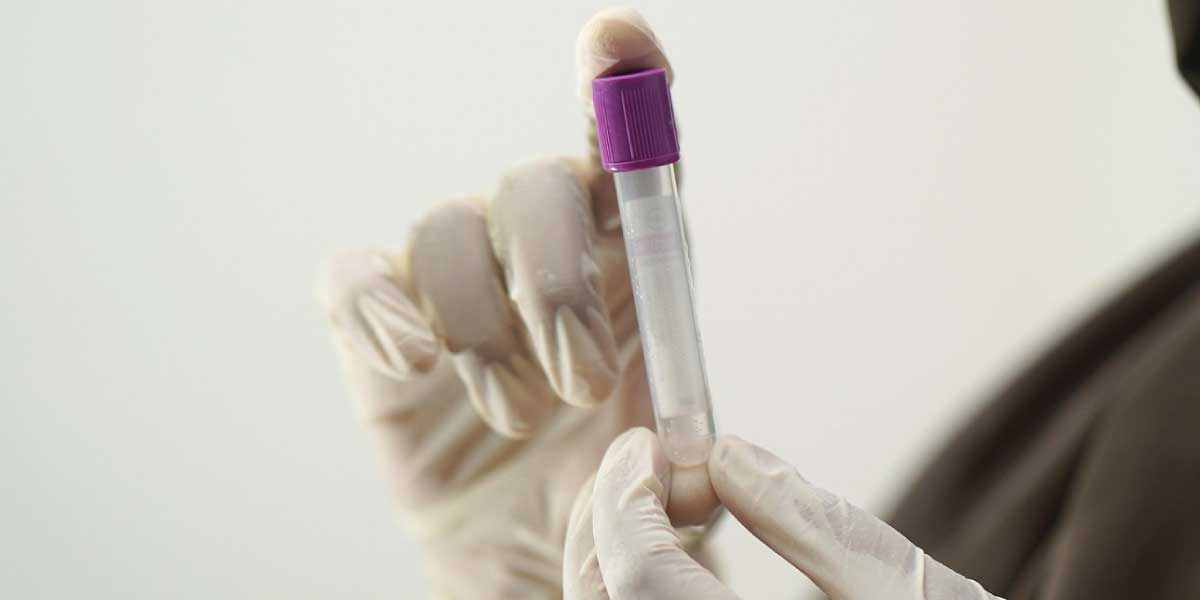 Leucemia